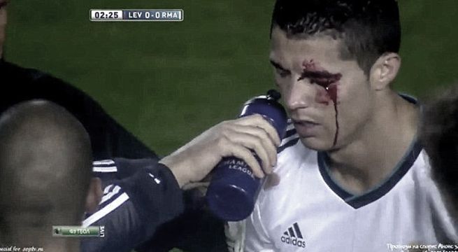 Cristiano Ronaldo: revelan imágenes del profundo corte que sufrió en el rostro