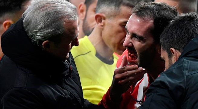 YouTube: el brutal golpe que sufrió Diego Godín que lo dejó sin dentadura