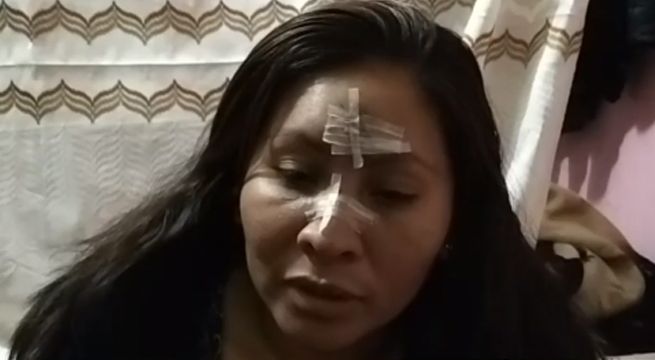 Cusco: liberan a sujeto que golpeó en el rostro a exesposa
