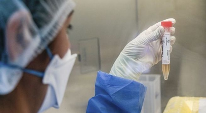 Covid-19 en Perú: Crean prueba molecular para diagnosticar en menos de una hora