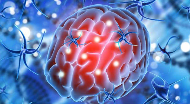 Enfermos graves de Covid-19 pueden sufrir daño cerebral