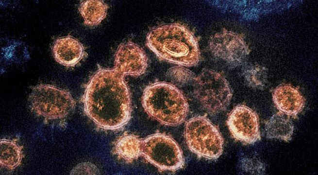 Casos de coronavirus en el mundo superan los 30 millones