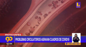 #Covid-19: Problemas circulatorios agravan cuadros de coronavirus