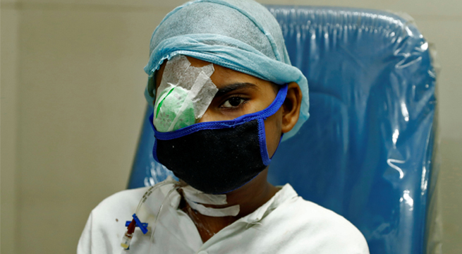 El “hongo negro” deja ciegas a personas en la India