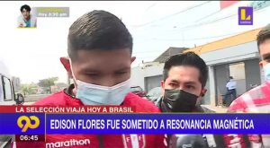 Edison Flores fue sometido a resonancia magnética