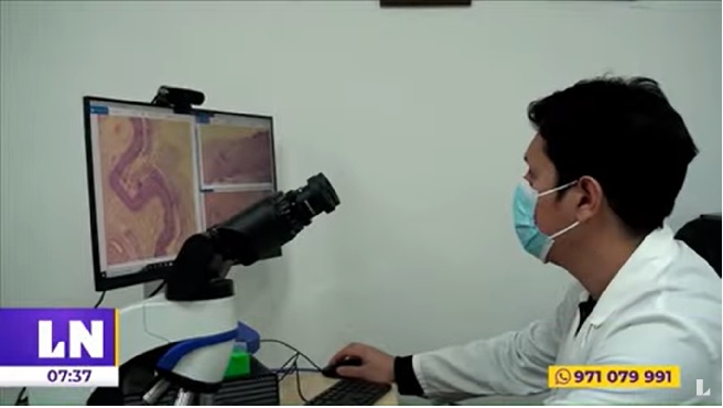 La Libertad: IREN implementó tecnología para mejorar detección del cáncer