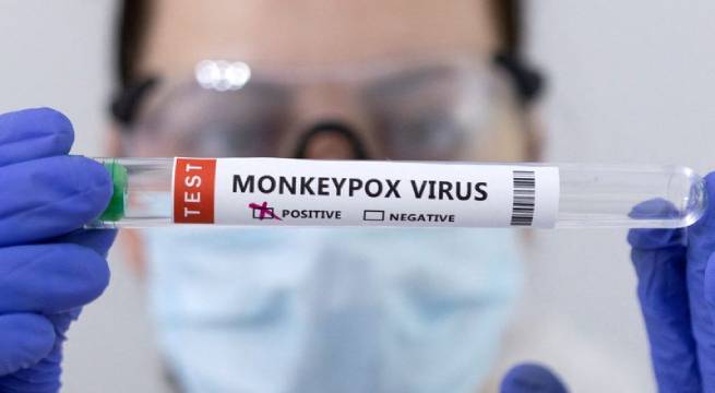 México y Cuba reportan inusuales muertes de dos pacientes con viruela del mono