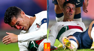 Durísimo: Cristiano Ronaldo recibió un duro golpe ante República Checa