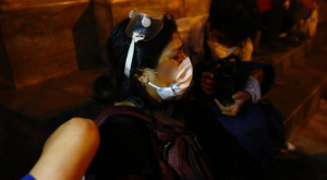 Protestas en Lima: periodista fue herida tras impacto de perdigones