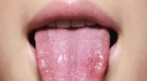 Por qué es importante cepillarse la lengua: conoce las razones