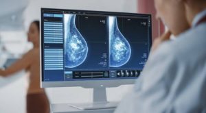 Usan inteligencia artificial en la detección y tratamiento del cáncer de mama