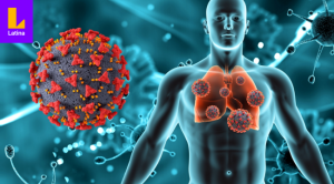 San Marcos: Lo que debemos saber sobre los contagios de la tuberculosis