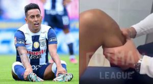 Increíble: el estado actual de la rodilla derecha de Christian Cueva