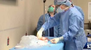 Realizan primer trasplante exitoso de un riñón de cerdo a humano