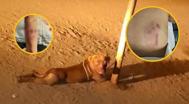 Trujillo: Niña queda en estado crítico tras ataque de perro pitbull