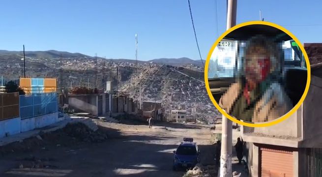 Perro ataca a anciana y le desfigura el rostro en Arequipa