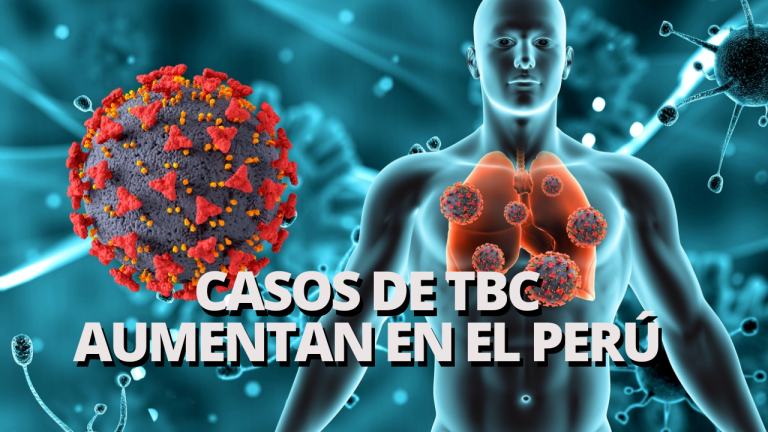 Perú es el segundo país de América con más casos de TBC