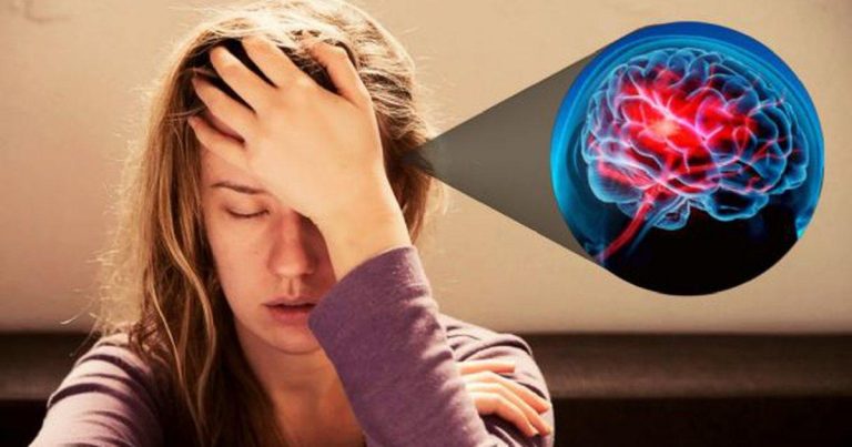 Infarto cerebral: Qué es, causas, síntomas, prevención y todo lo que debe saber