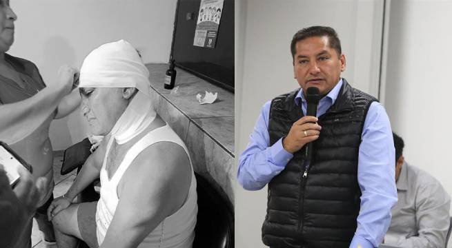 Rompen la cabeza a alcalde de Comas en asalto a mano armada: «Me metieron 3 cachazos» | VIDEO