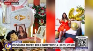 Huancayo: empresaria muere tras someterse a liposucción