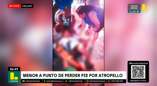 Callao: conductor atropella a menor de 12 años y se da a la fuga